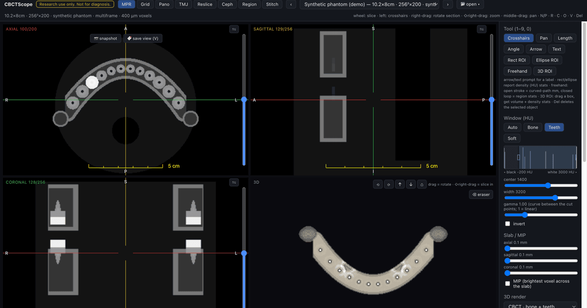 CBCTScope MPR view: axial, sagittal, coronal panes with crosshairs and a 3D render of the arch