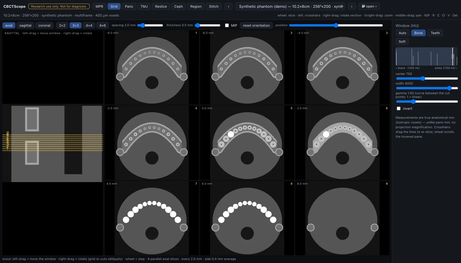 CBCTScope grid mode: parallel axial slices with a sagittal scout, spacing and thickness controls