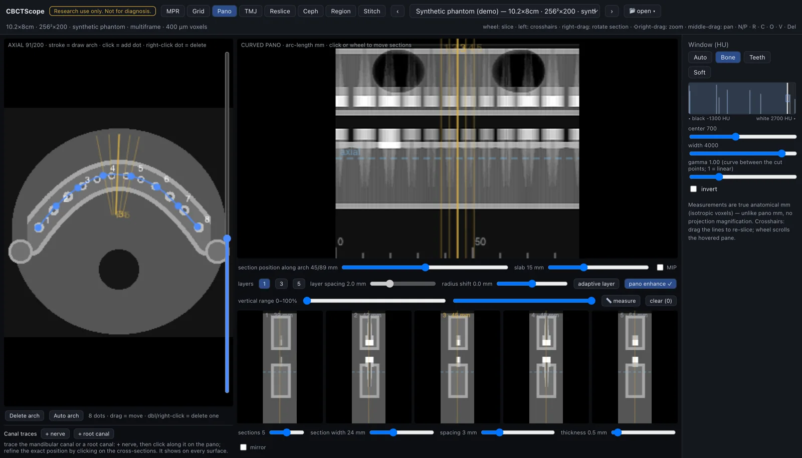 CBCTScope pano mode: arch spline on the axial slice, curved panoramic reconstruction, perpendicular cross-sections
